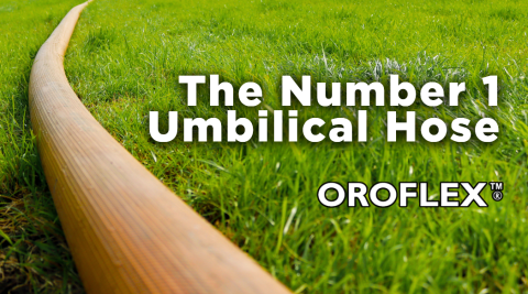The Number One Umbilical Hose